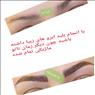 تاتو صورت هاشور و فیبروز